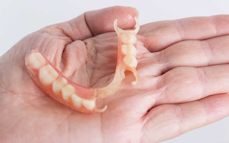 ノンクラスプデンチャー